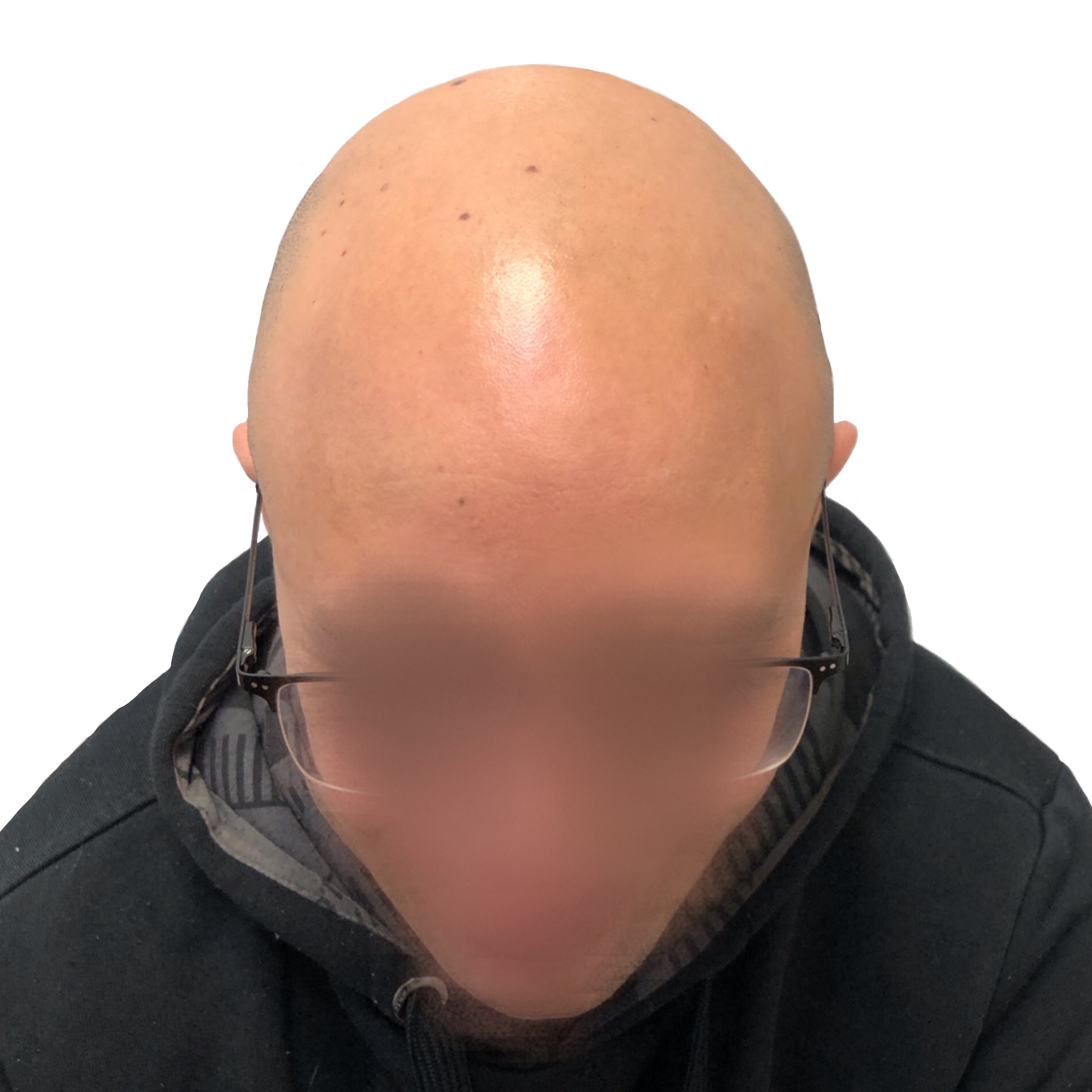 Antes