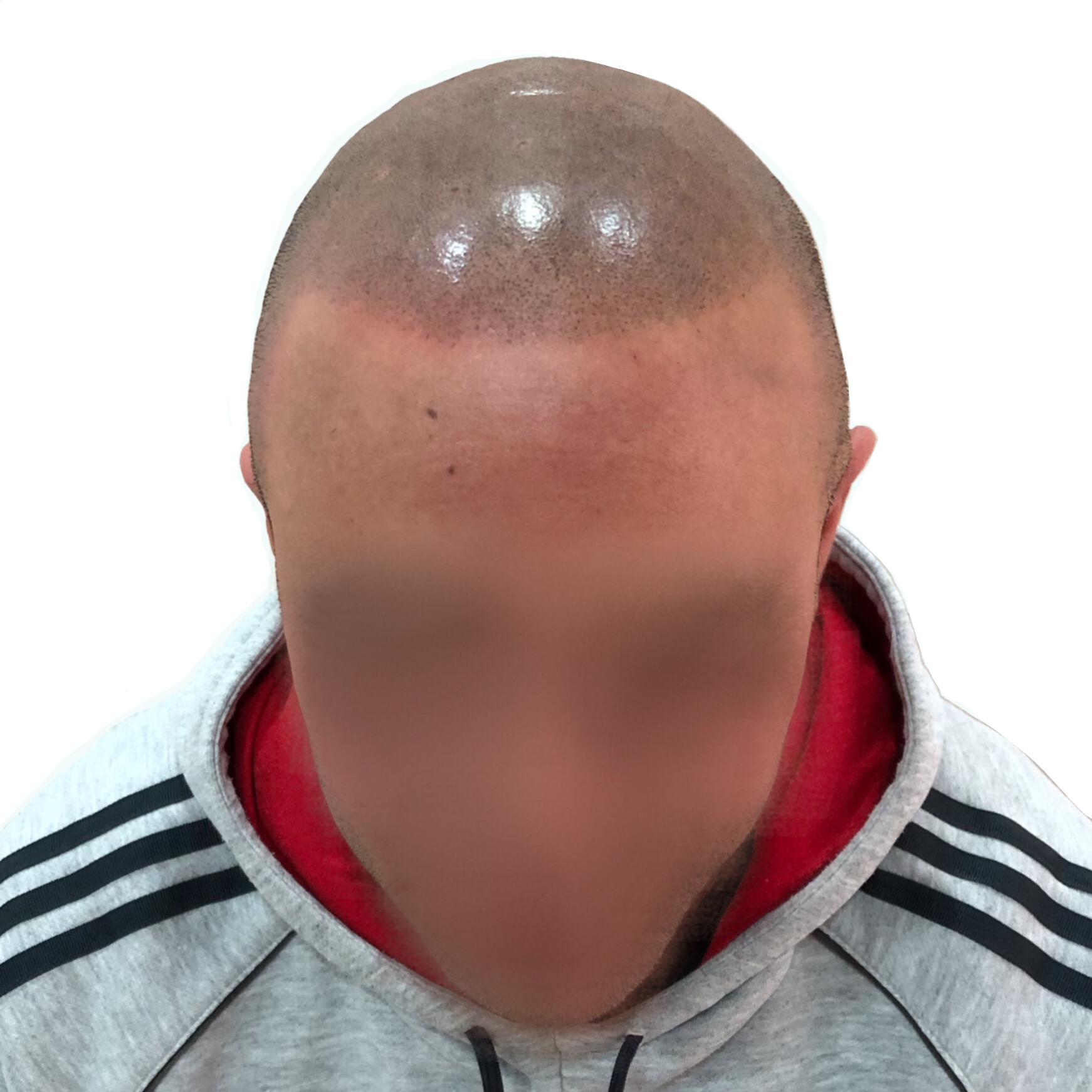 Después
